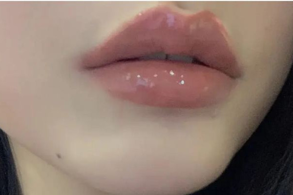 豐唇大概要多少錢 豐唇有哪些方法 豐唇大概要多少錢 豐唇有哪些方法