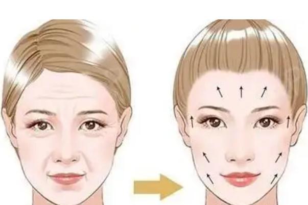 拉皮手術是拉的筋膜層還是皮膚層 拉皮手術是大手術嗎 拉皮手術是拉的筋膜層還是皮膚層 拉皮手術是大手術嗎