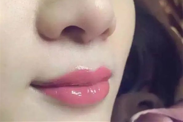 漂唇一般幾天可以恢復(fù) 漂唇后的注意事項 漂唇一般幾天可以恢復(fù) 漂唇后的注意事項