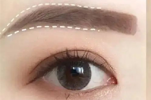 激光洗眉后色素沉著怎么去除 激光洗眉后可以涂生長(zhǎng)因子嗎