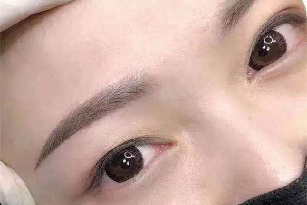 激光洗眉毛會不會留疤 激光洗眉幾天可以掉痂 激光洗眉毛會不會留疤 激光洗眉幾天可以掉痂