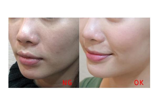 童顏針是生長因子嗎 童顏針會栓塞嗎 童顏針是生長因子嗎 童顏針會栓塞嗎