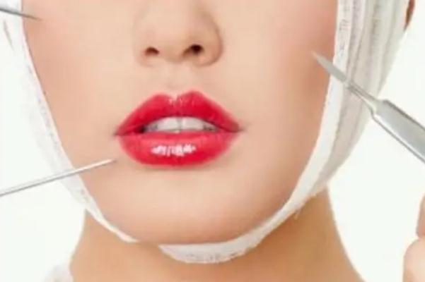 童顏針可以填充法令紋嗎 童顏針可以打哪些部位 童顏針可以填充法令紋嗎 童顏針可以打哪些部位