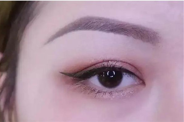 激光洗眉后色素沉著怎么去除 激光洗眉后可以涂生長(zhǎng)因子嗎 激光洗眉后色素沉著怎么去除 激光洗眉后可以涂生長(zhǎng)因子嗎