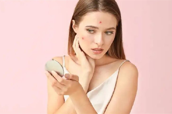 刷酸會不會破壞肌膚屏障 刷酸有什么危害 刷酸會不會破壞肌膚屏障 刷酸有什么危害