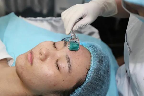 激光祛痘會(huì)留下痘坑嗎 激光祛痘會(huì)不會(huì)對(duì)皮膚有影響 激光祛痘會(huì)留下痘坑嗎 激光祛痘會(huì)不會(huì)對(duì)皮膚有影響