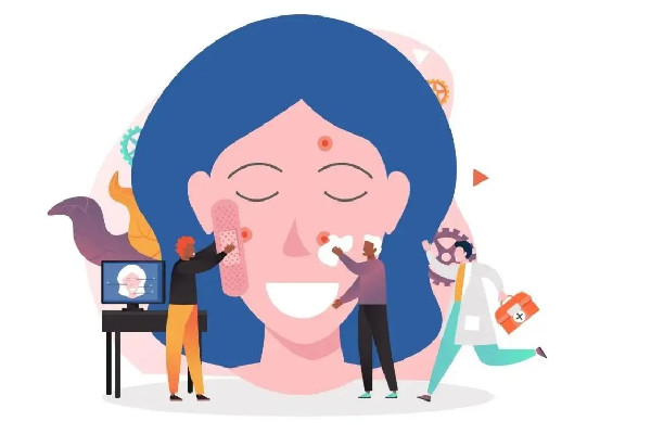 刷酸可以去雞皮膚嗎 刷酸去雞皮膚幾次才有明顯的效果 刷酸可以去雞皮膚嗎 刷酸去雞皮膚幾次才有明顯的效果