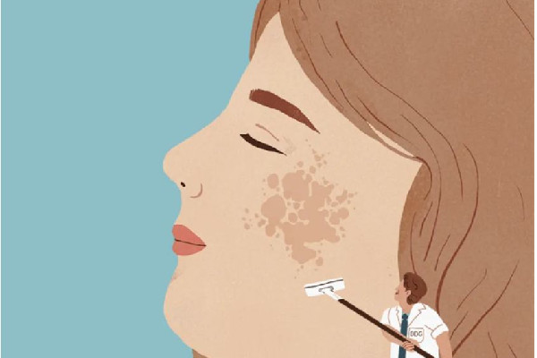 刷酸的時(shí)候臉上火辣辣的正常嗎 刷酸后臉部發(fā)紅怎么辦 刷酸的時(shí)候臉上火辣辣的正常嗎 刷酸后臉部發(fā)紅怎么辦