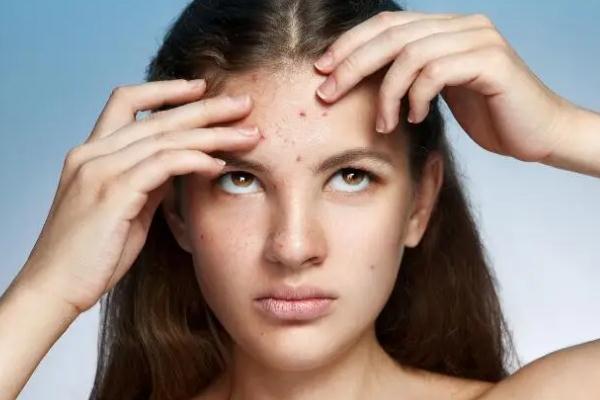 紅藍(lán)光祛痘的作用及副作用 紅藍(lán)光祛痘到底有沒(méi)有效果 紅藍(lán)光祛痘的作用及副作用 紅藍(lán)光祛痘到底有沒(méi)有效果