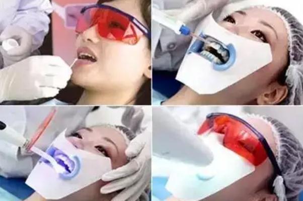 冷光美白牙齒會反彈嗎 冷光美白牙齒會酸幾天 冷光美白牙齒會反彈嗎 冷光美白牙齒會酸幾天