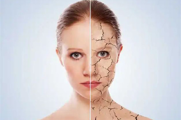 膠原蛋白填充后為什么越來越腫 膠原蛋白填充多久恢復(fù)自然 膠原蛋白填充后為什么越來越腫 膠原蛋白填充多久恢復(fù)自然