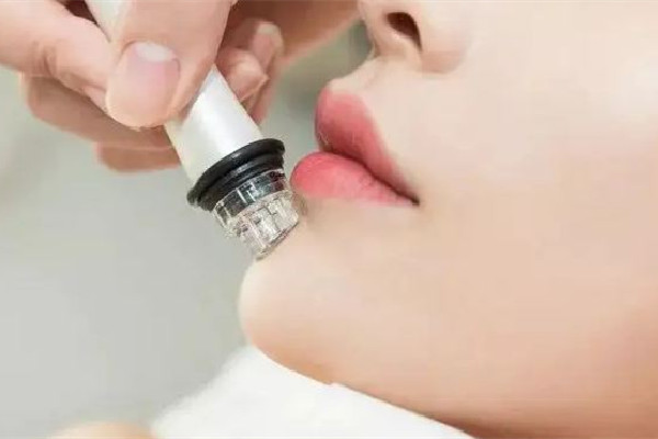 膠原蛋白填充后可以吃消炎藥嗎 膠原蛋白填充后有硬塊如何處理 膠原蛋白填充后可以吃消炎藥嗎 膠原蛋白填充后有硬塊如何處理