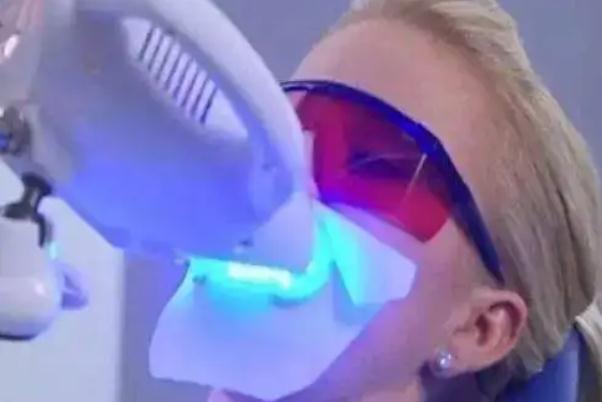 冷光美白牙齒可以抽煙嗎 冷光美白牙齒可以喝酒嗎 冷光美白牙齒可以抽煙嗎 冷光美白牙齒可以喝酒嗎