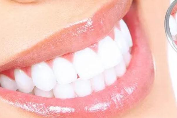 冷光美白牙齒后悔了 冷光美白牙齒的副作用 冷光美白牙齒后悔了 冷光美白牙齒的副作用