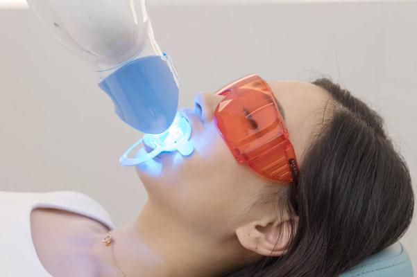 冷光美白牙齒要多少錢一次 冷光美白牙齒對牙齒有什么傷害 冷光美白牙齒要多少錢一次 冷光美白牙齒對牙齒有什么傷害