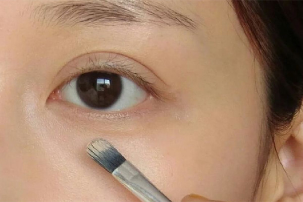 淚溝填充后黑眼圈重怎么回事 淚溝填充后怎么護(hù)理 淚溝填充后黑眼圈重怎么回事 淚溝填充后怎么護(hù)理