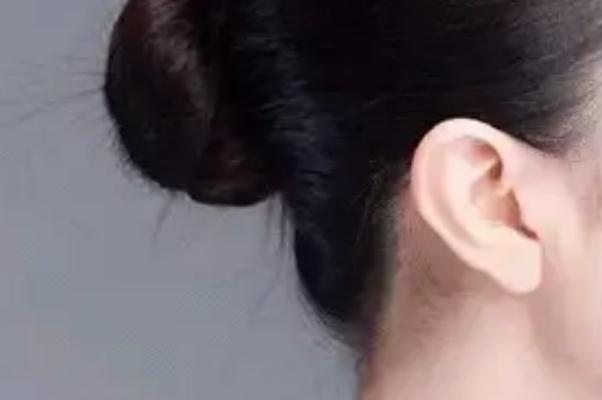 豐耳垂最好的方法 豐耳垂是永久的嗎 豐耳垂最好的方法 豐耳垂是永久的嗎