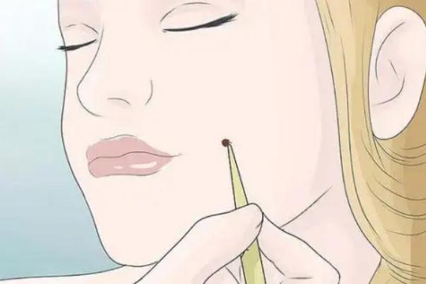 人造酒窩的價(jià)格 人造酒窩是不是一天比一天好 人造酒窩的價(jià)格 人造酒窩是不是一天比一天好