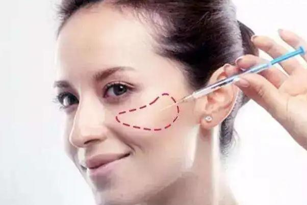 蘋果肌復(fù)位的注意事項(xiàng) 蘋果肌復(fù)位后要戴面罩嗎 蘋果肌復(fù)位的注意事項(xiàng) 蘋果肌復(fù)位后要戴面罩嗎