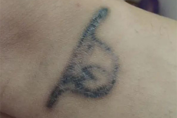 洗紋身要隔多久洗第二次 洗紋身按什么收費(fèi)的 洗紋身要隔多久洗第二次 洗紋身按什么收費(fèi)的
