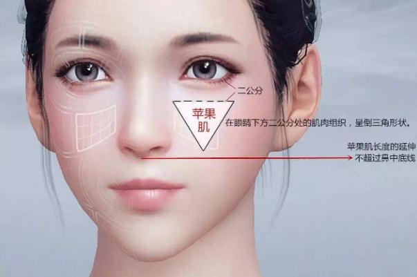 蘋(píng)果肌復(fù)位術(shù)怎么做 蘋(píng)果肌復(fù)位術(shù)可以保持多久 蘋(píng)果肌復(fù)位術(shù)怎么做 蘋(píng)果肌復(fù)位術(shù)可以保持多久