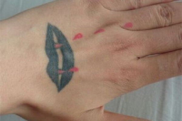 洗紋身會(huì)有增生疤痕嗎 洗紋身有點(diǎn)凸起來正常嗎 洗紋身會(huì)有增生疤痕嗎 洗紋身有點(diǎn)凸起來正常嗎