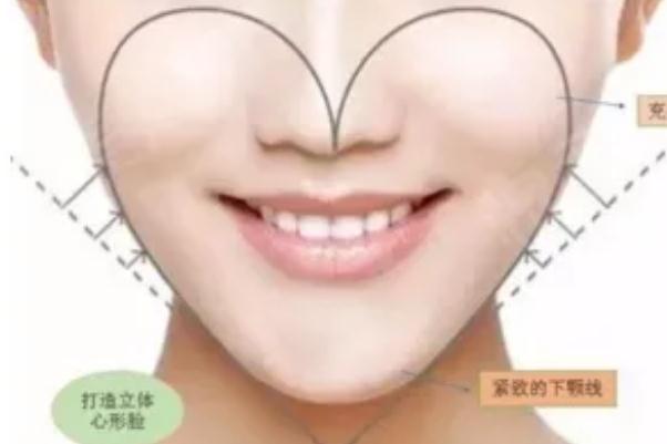 蘋果肌復位術多少錢 蘋果肌復位最好的辦法 蘋果肌復位術多少錢 蘋果肌復位最好的辦法