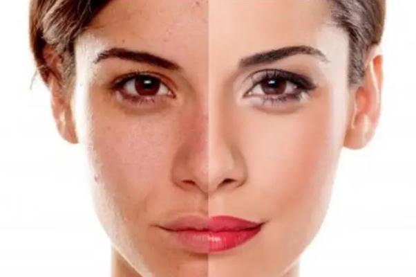 皮膚暗黃會造成什么影響 皮膚暗黃會自然恢復(fù)嗎 皮膚暗黃會造成什么影響 皮膚暗黃會自然恢復(fù)嗎