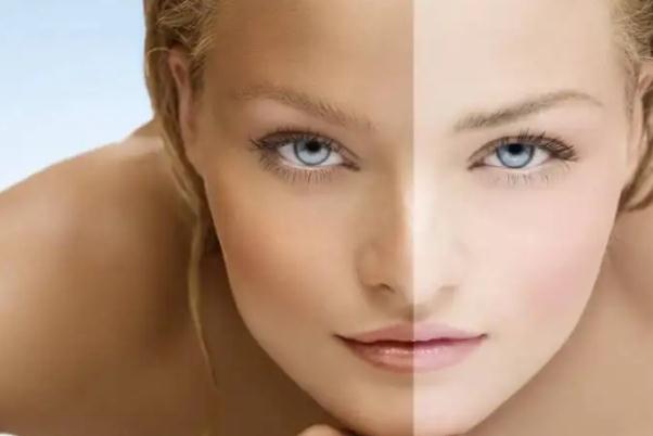 皮膚暗黃會造成什么影響 皮膚暗黃會自然恢復(fù)嗎 皮膚暗黃會造成什么影響 皮膚暗黃會自然恢復(fù)嗎