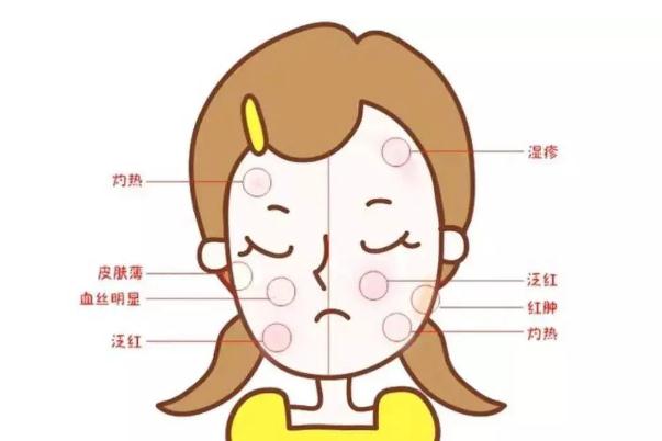 皮膚曬傷有灼燒感 皮膚曬傷有什么辦法 皮膚曬傷有灼燒感 皮膚曬傷有什么辦法