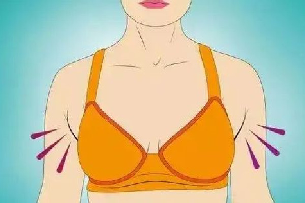 副乳切除手術(shù)會有疤痕嗎 副乳切除手術(shù)怎么才能看不到疤痕 副乳切除手術(shù)會有疤痕嗎 副乳切除手術(shù)怎么才能看不到疤痕