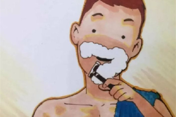 刮胡子有黑印怎么消除 刮胡子為什么會(huì)變青 刮胡子有黑印怎么消除 刮胡子為什么會(huì)變青