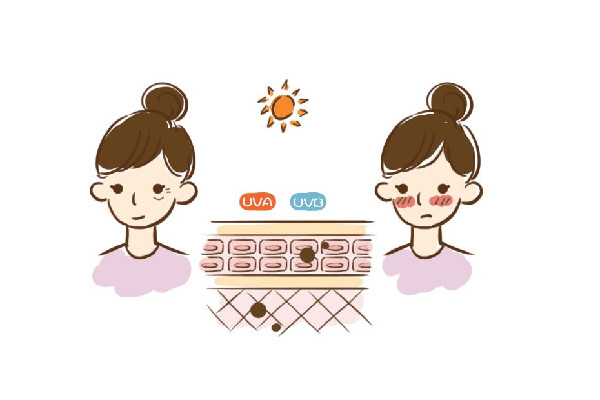 皮膚曬傷有刺痛感怎么辦 皮膚曬傷可以冰敷嗎 皮膚曬傷有刺痛感怎么辦 皮膚曬傷可以冰敷嗎