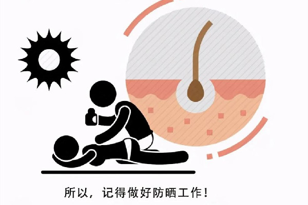 皮膚曬傷怎么緩解疼痛 皮膚曬傷要忌口嗎 皮膚曬傷怎么緩解疼痛 皮膚曬傷要忌口嗎