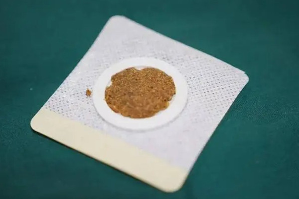 三伏貼可以自己在家貼嗎 三伏貼怎么貼效果好 三伏貼可以自己在家貼嗎 三伏貼怎么貼效果好