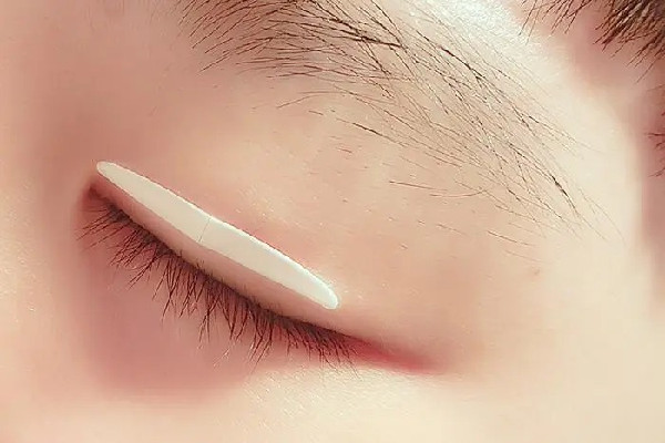 雙眼皮貼直接撕會(huì)怎樣 雙眼皮貼怎么取下來(lái) 雙眼皮貼直接撕會(huì)怎樣 雙眼皮貼怎么取下來(lái)