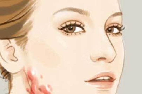 武漢哪個(gè)醫(yī)院去疤痕效果最好 武漢去疤痕是去醫(yī)院還是整形醫(yī)院 武漢哪個(gè)醫(yī)院去疤痕效果最好 武漢去疤痕是去醫(yī)院還是整形醫(yī)院