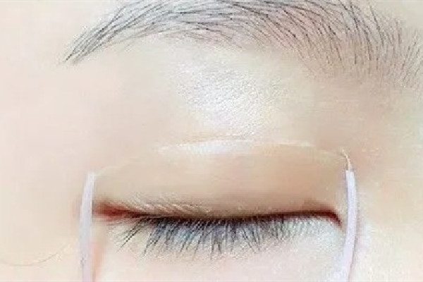 雙眼皮貼直接撕會(huì)怎樣 雙眼皮貼怎么取下來(lái) 雙眼皮貼直接撕會(huì)怎樣 雙眼皮貼怎么取下來(lái)