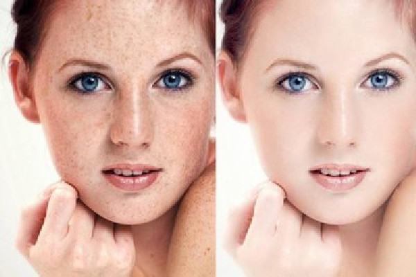 武漢去黑色素沉淀哪里好 武漢激光手術(shù)哪個(gè)好 武漢去黑色素沉淀哪里好 武漢激光手術(shù)哪個(gè)好