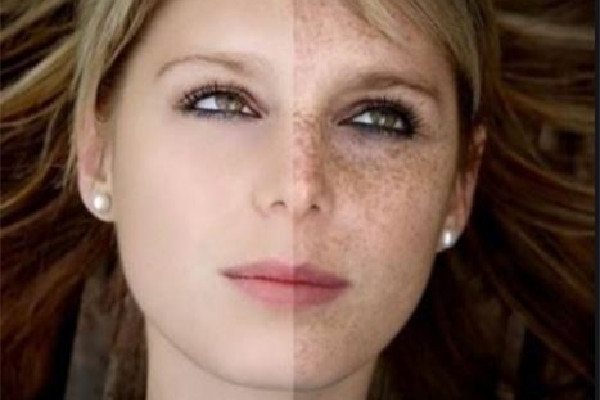 武漢去黑色素沉淀哪里好 武漢激光手術(shù)哪個(gè)好 武漢去黑色素沉淀哪里好 武漢激光手術(shù)哪個(gè)好