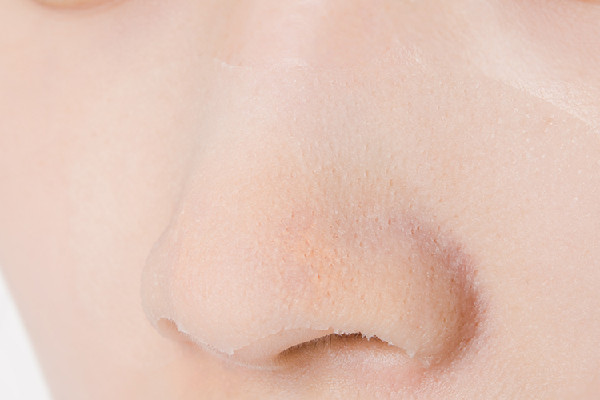 去黑頭后用什么修復(fù) 去黑頭后可以用爽膚水收縮毛孔嗎 去黑頭后用什么修復(fù) 去黑頭后可以用爽膚水收縮毛孔嗎