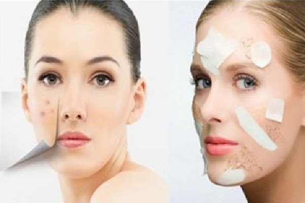 去黑頭是鼻貼好還是泥膜好 去黑頭用什么護(hù)膚品 去黑頭是鼻貼好還是泥膜好 去黑頭用什么護(hù)膚品