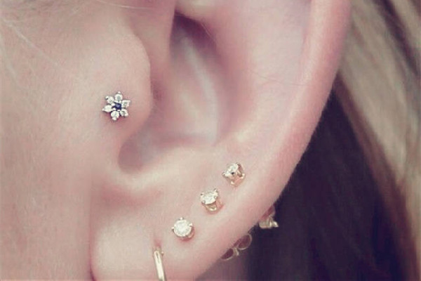 打耳洞增生疙瘩怎么辦 打耳洞為什么會(huì)長疙瘩 打耳洞增生疙瘩怎么辦 打耳洞為什么會(huì)長疙瘩