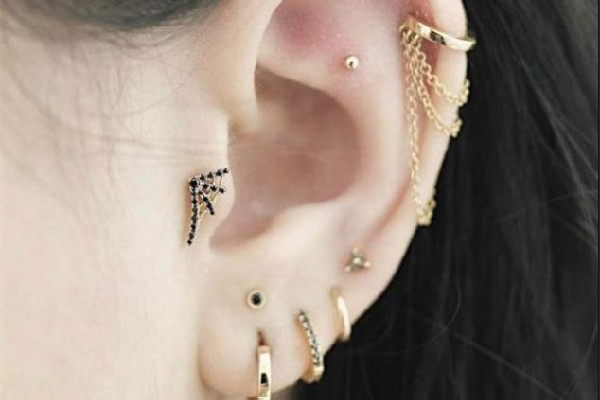 打耳洞增生疙瘩怎么辦 打耳洞為什么會(huì)長疙瘩 打耳洞增生疙瘩怎么辦 打耳洞為什么會(huì)長疙瘩