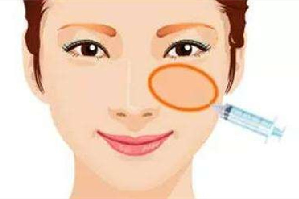 武漢玻尿酸填充哪家醫(yī)院好 武漢玻尿酸填充可以用醫(yī)保嗎 武漢玻尿酸填充哪家醫(yī)院好 武漢玻尿酸填充可以用醫(yī)保嗎