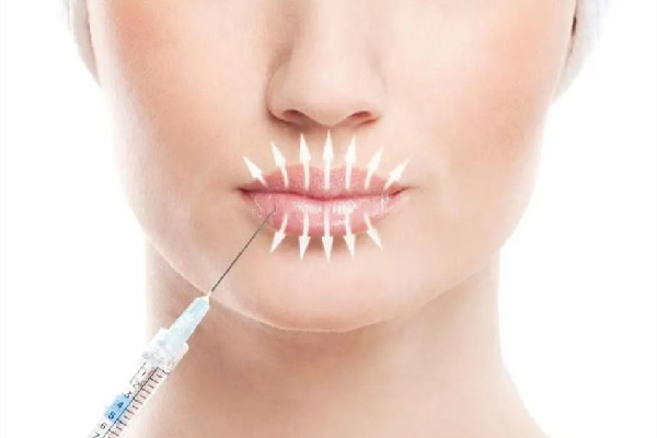 武漢豐唇哪個(gè)醫(yī)院自然 武漢豐唇多少錢 武漢豐唇哪個(gè)醫(yī)院自然 武漢豐唇多少錢