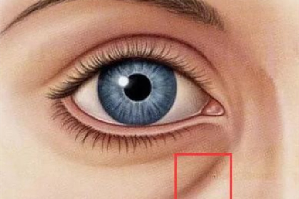 武漢淚溝填充哪家醫(yī)院最好 武漢淚溝脂肪填充多少錢 武漢淚溝填充哪家醫(yī)院最好 武漢淚溝脂肪填充多少錢