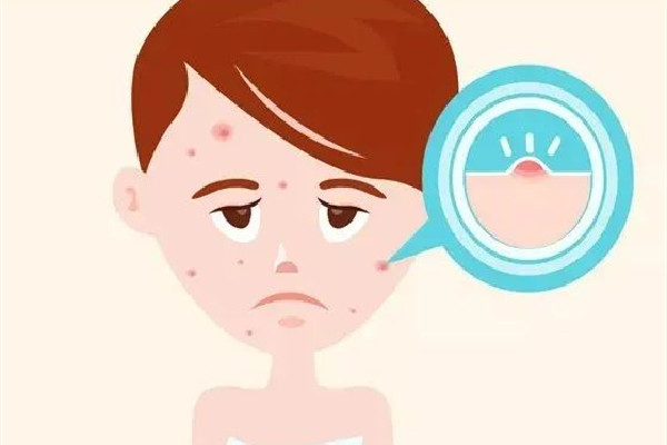 武漢點(diǎn)陣激光醫(yī)院排名 武漢點(diǎn)陣激光多少錢(qián)一次 武漢點(diǎn)陣激光醫(yī)院排名 武漢點(diǎn)陣激光多少錢(qián)一次