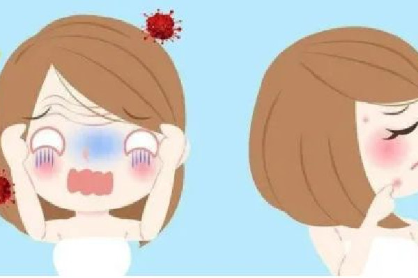 武漢去痘坑醫(yī)院哪家好 武漢去痘坑修復凹洞手術多少錢 武漢去痘坑醫(yī)院哪家好 武漢去痘坑修復凹洞手術多少錢