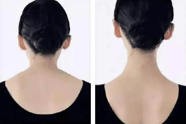 武漢打瘦肩針在哪里打 武漢瘦肩針打什么牌子的 武漢打瘦肩針在哪里打 武漢瘦肩針打什么牌子的